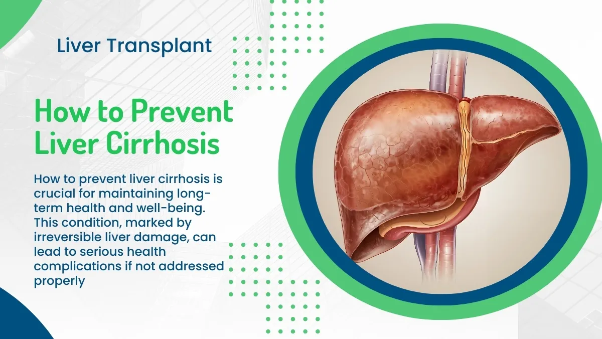 How to Prevent Liver Cirrhosis