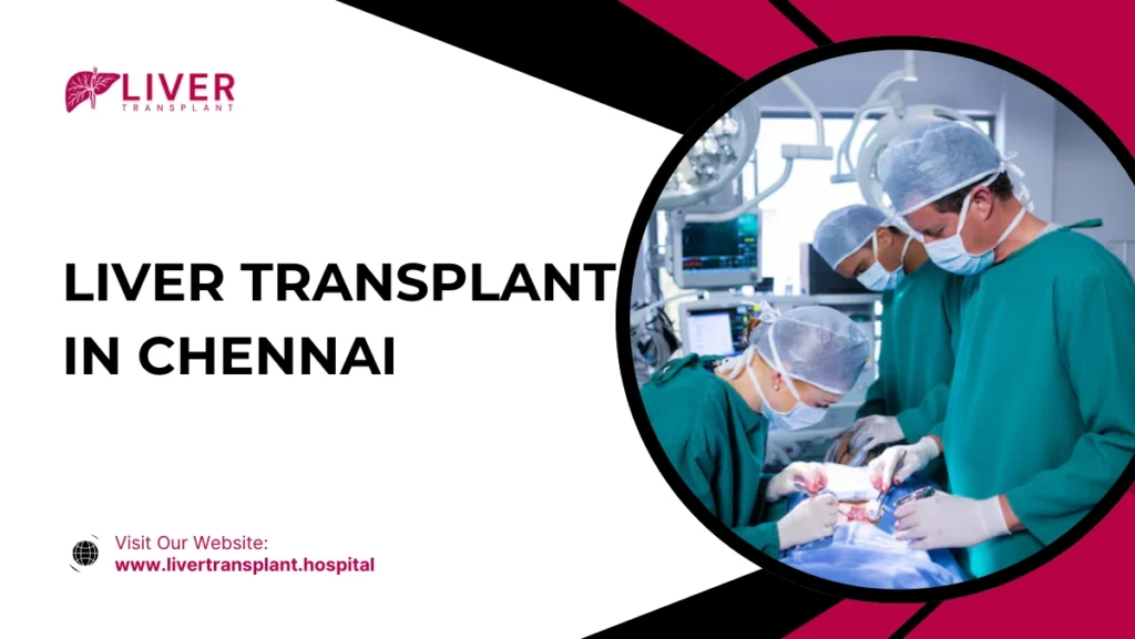Liver Transplant in Chennai
