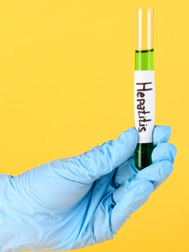 Testing For Viral Hepatitis