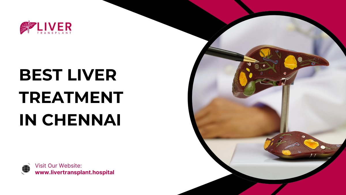 Best Liver Treatment in Chennai