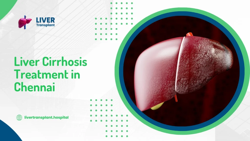 liver cirrhosis treatment in chennai