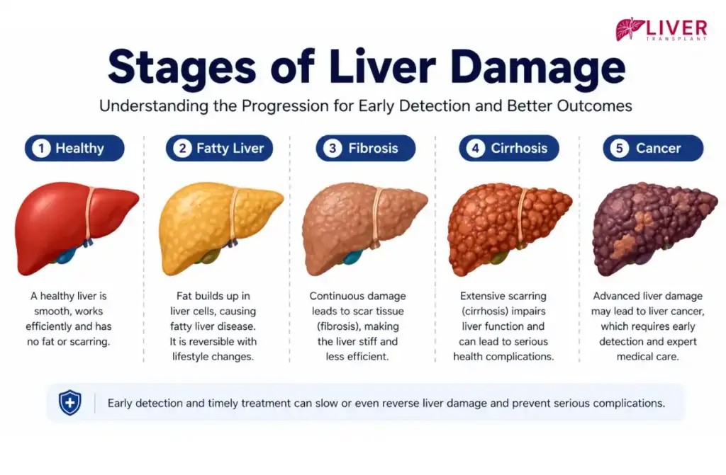 Liver Disease Treatment