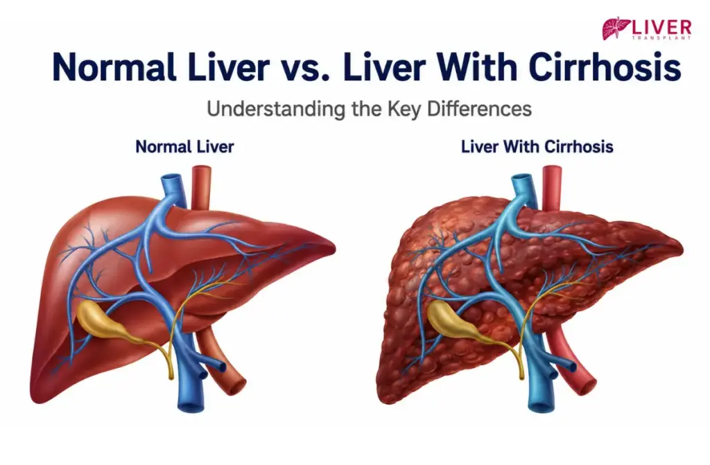 Treatment of Hepatitis