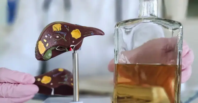 Alcoholic Liver Disease