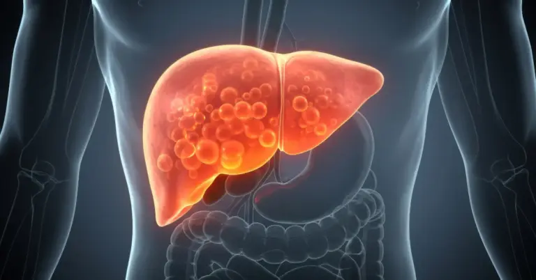 Fatty Liver Disease