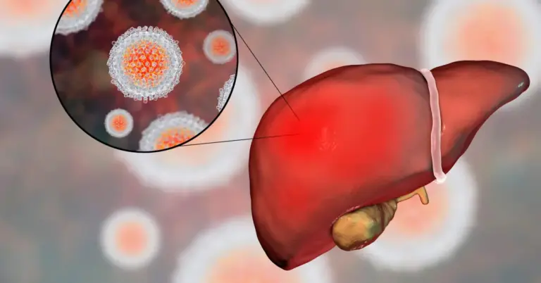 Hepatitis C