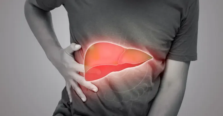 Liver Cirrhosis