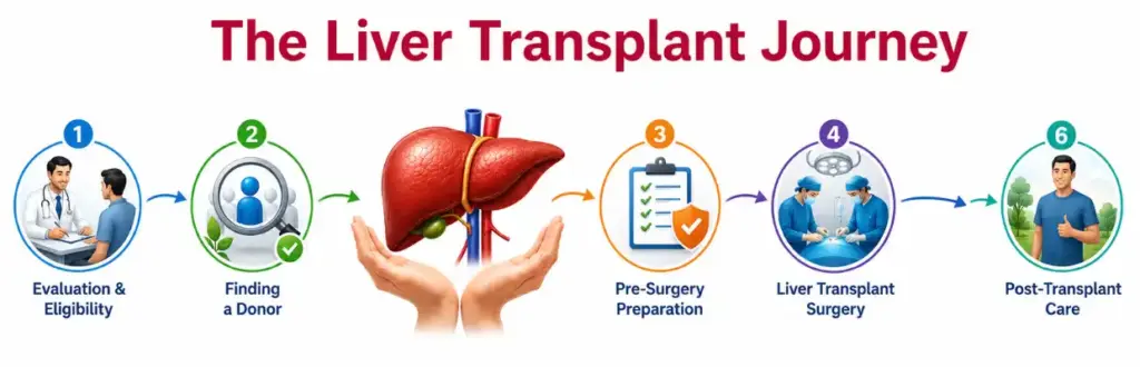 Understanding Liver Transplant Eligibility