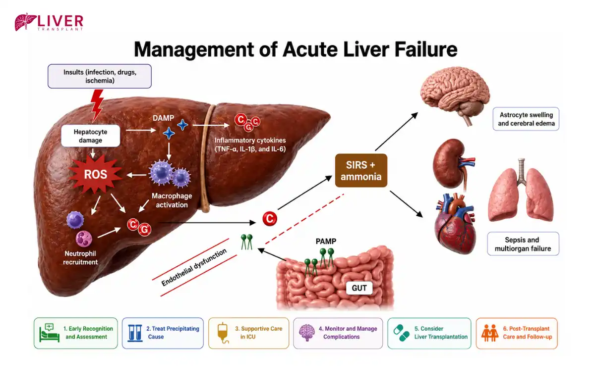 Acute Liver Failure