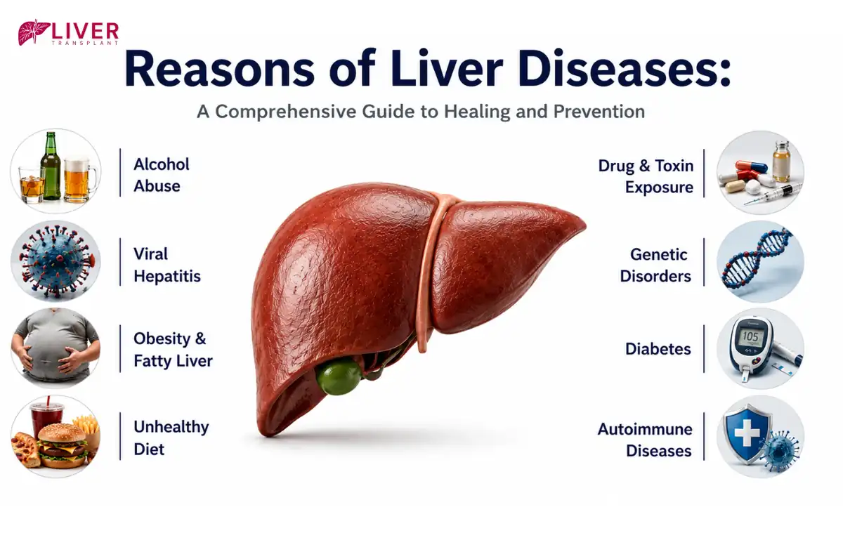 Alcoholic Liver Disease