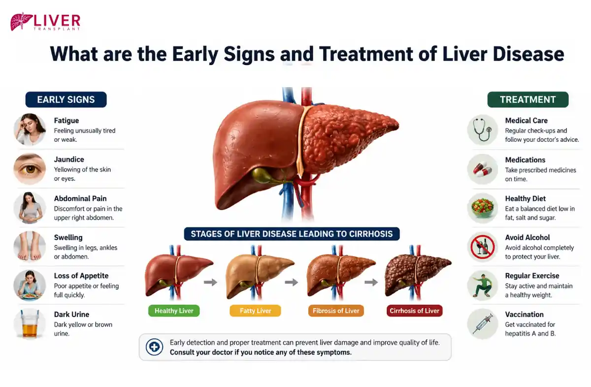 Liver Cirrhosis