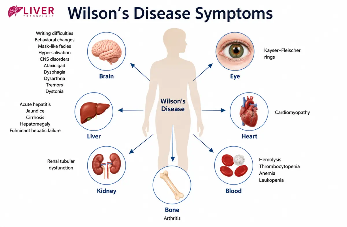 Wilsons Disease