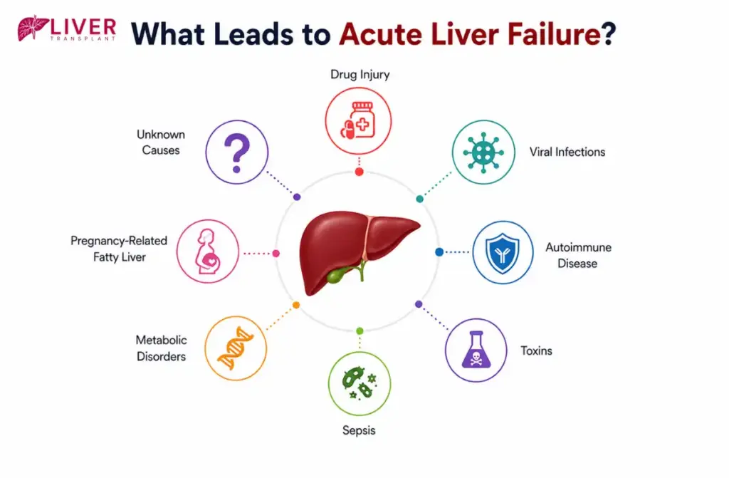 Causes of Acute Liver Failure 