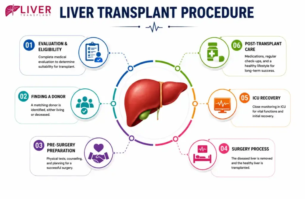 Liver Transplant Cost 