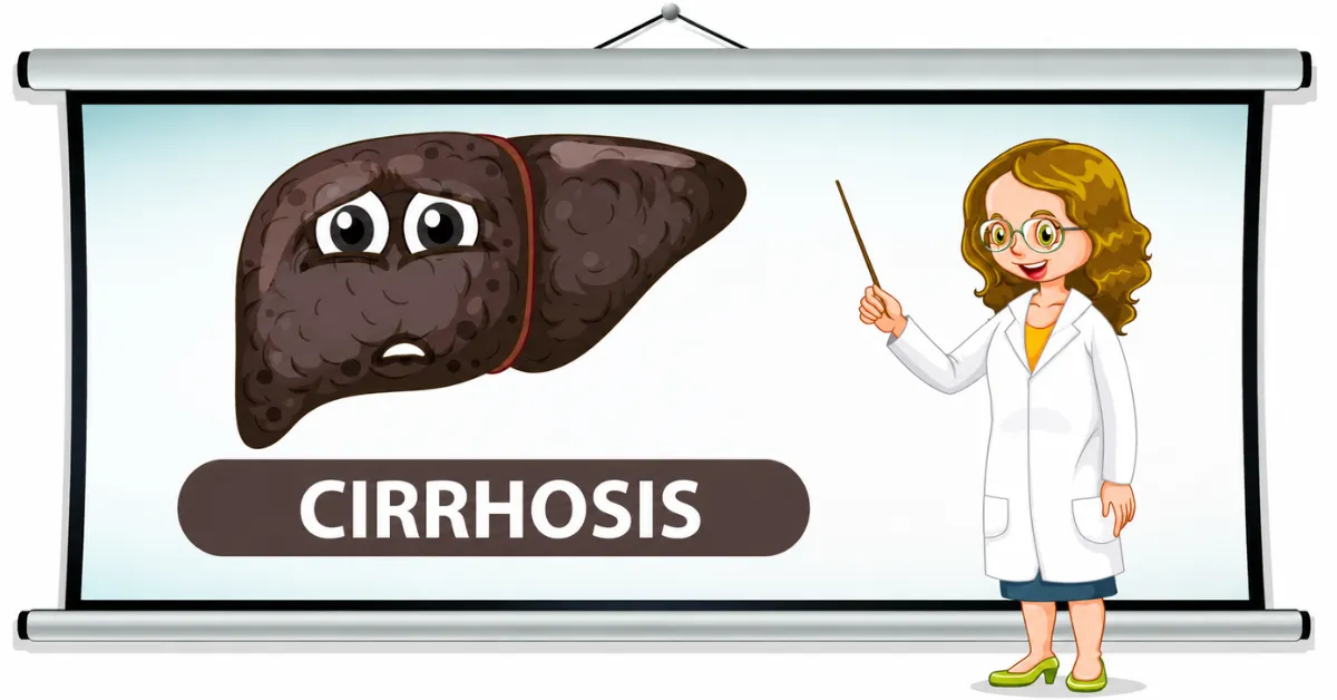 Prevention of Liver Cirrhosis